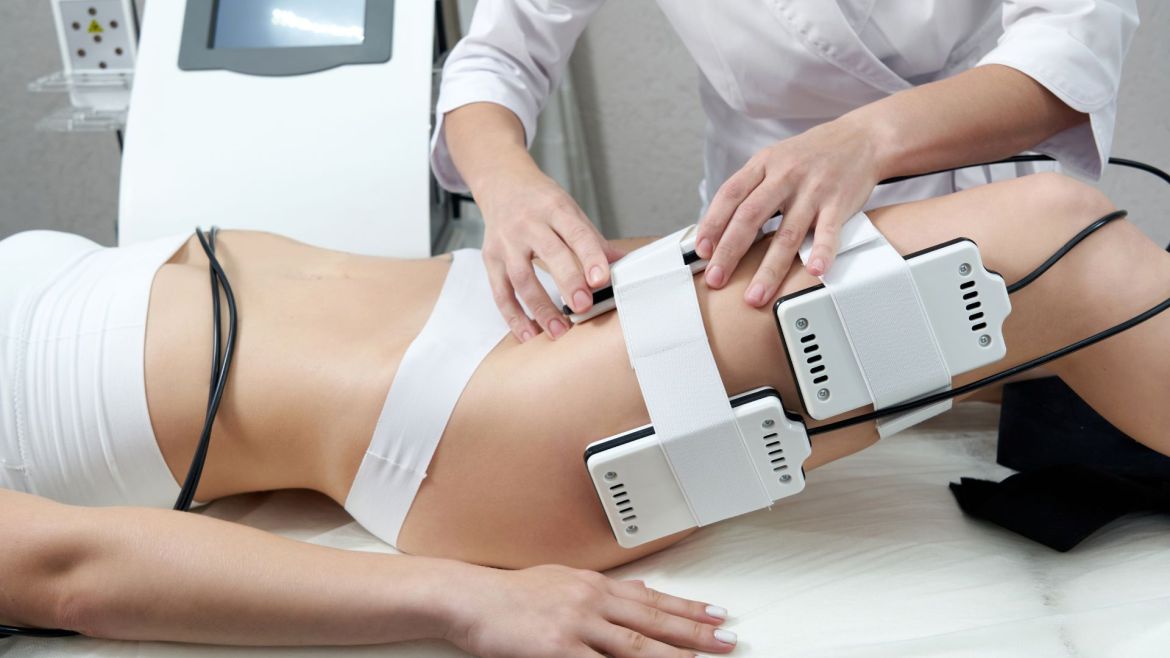 Electrostimulare